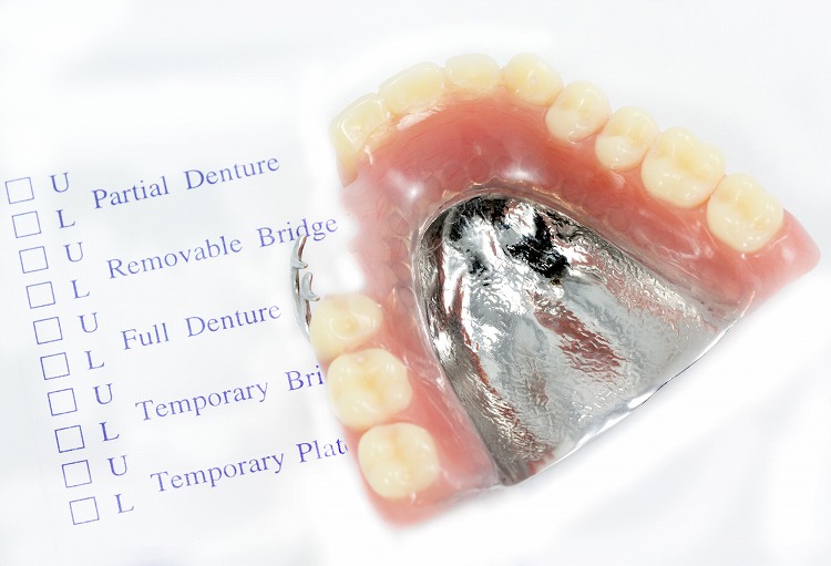 入れ歯の作製