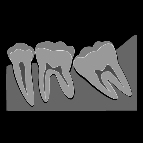当院の親知らず抜歯の特徴